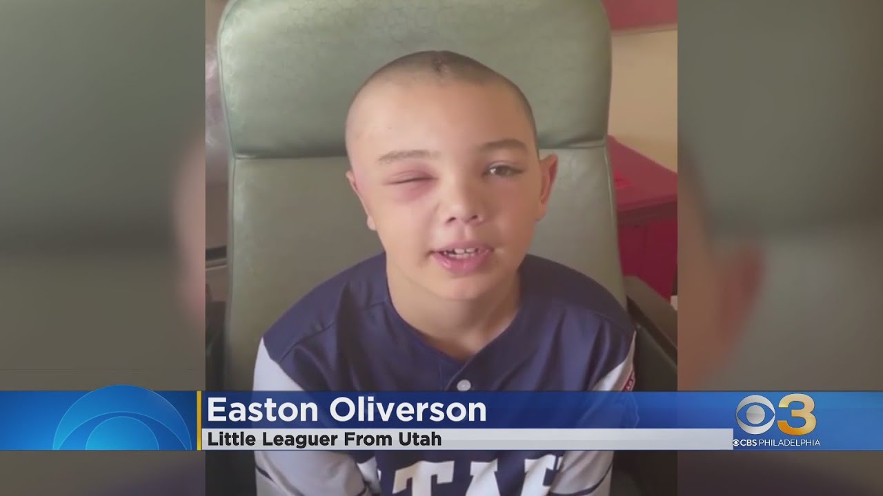 Little leaguer who was injured after fall from bunk bed in Williamsport is back in Utah