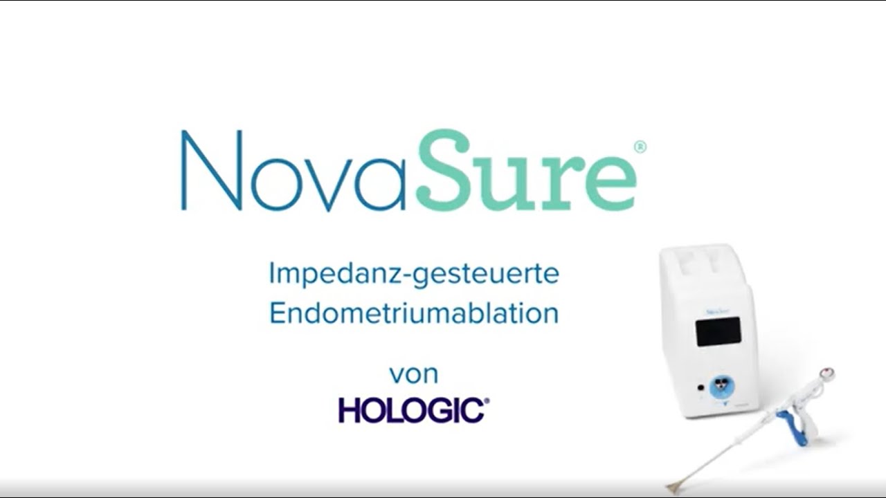 NovaSure&reg; &ndash; Impedanz-gesteuerte Endometriumablation