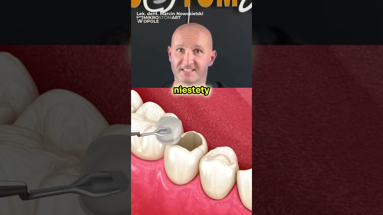 Dlaczego Dentysta Wkłada To Do Zęba? 😳🤔