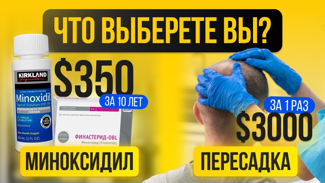 Мин и фин vs пересадка: Сколько реально стоит вернуть волосы?