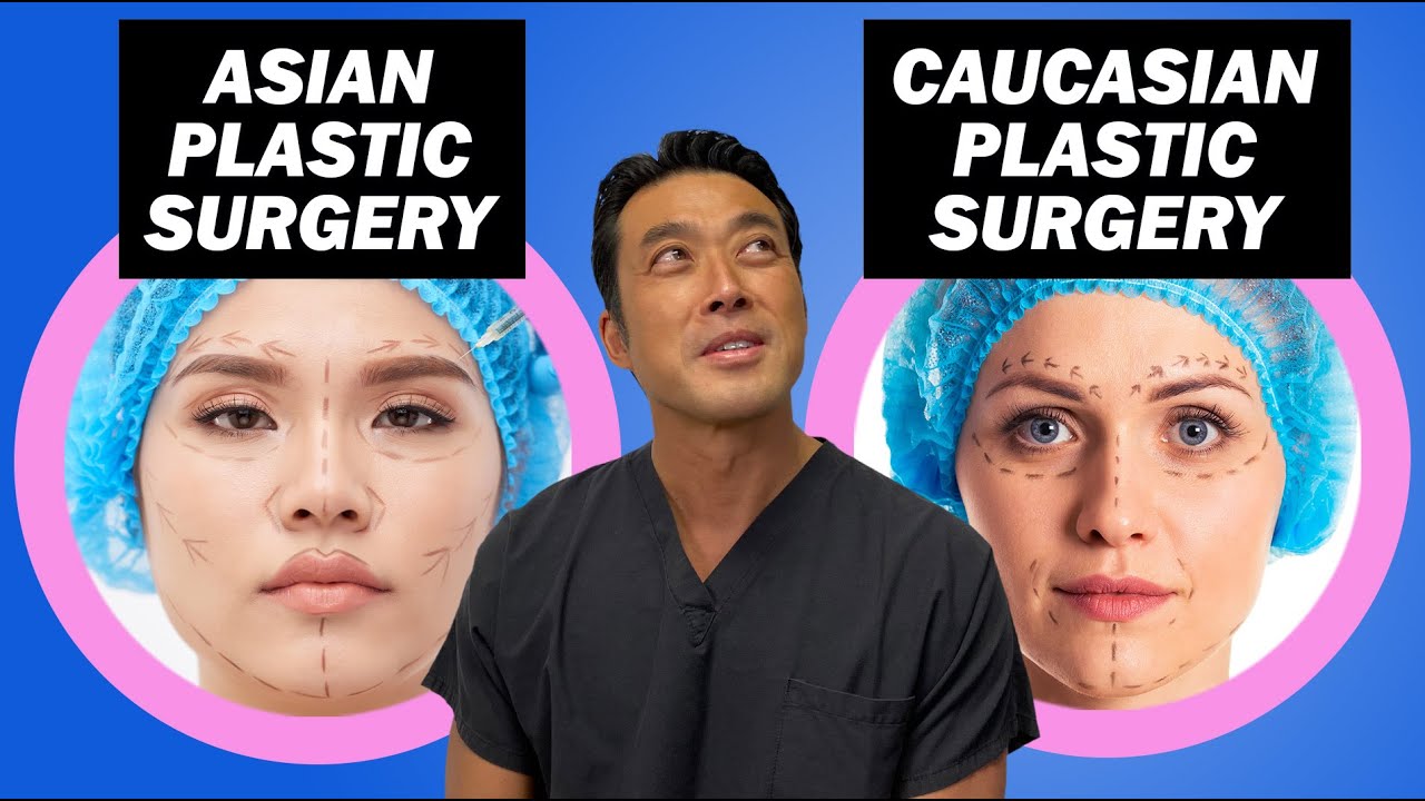 Asian vs  Caucasian Plastic Surgery The Surprising Truth!