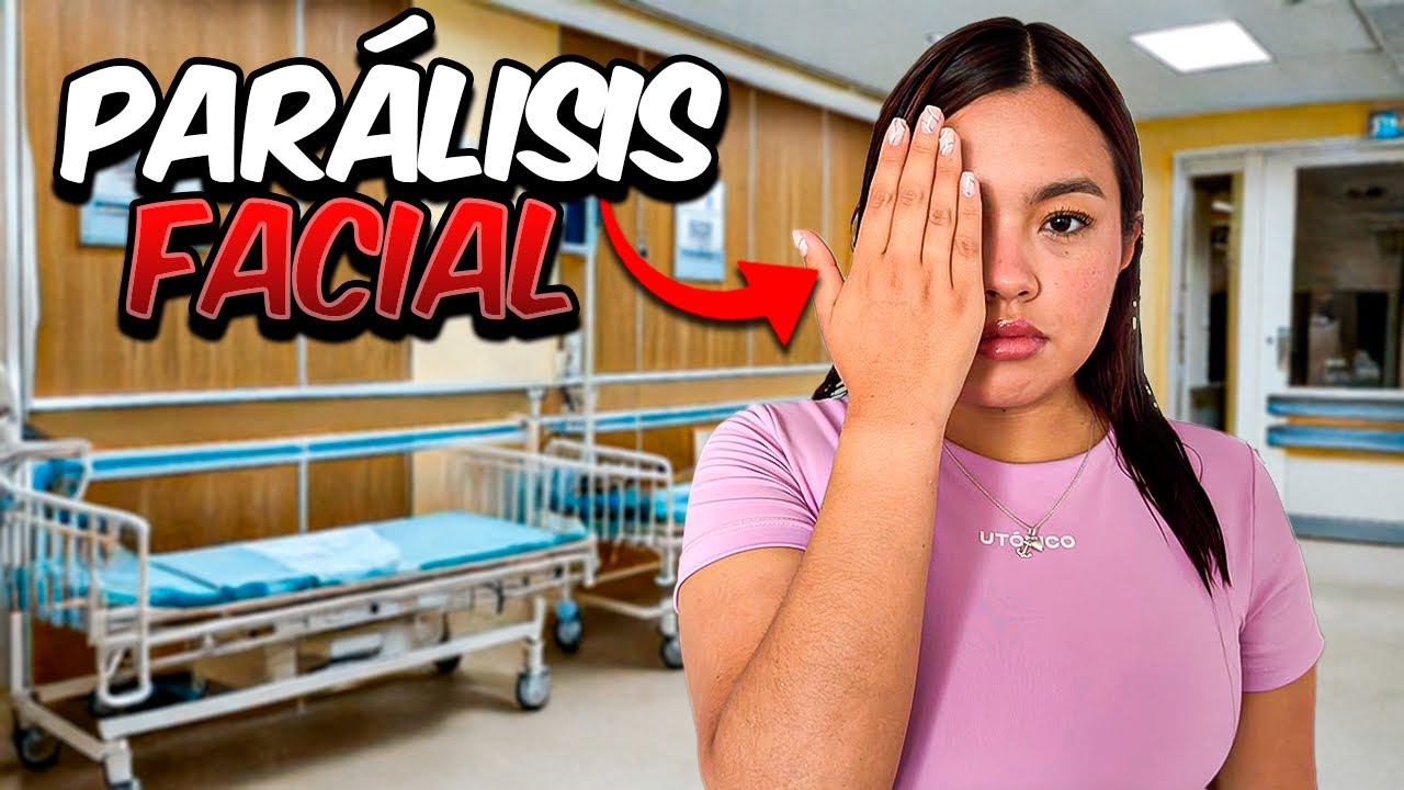 TENGO PARALISIS FACIAL | MI EXPERIENCIA REAL😥