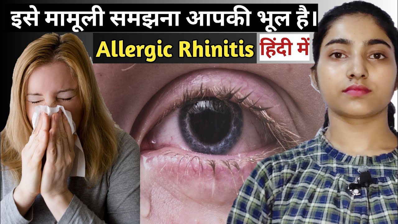 allergic rhinitis kya hai|Allergic rhinitis causes and risk factors|symptoms|Treatment|