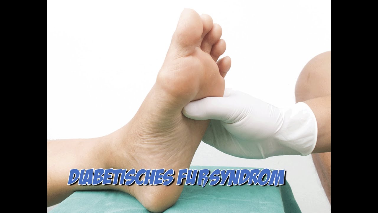 Diabetisches Fu&szlig;syndrom | Krankheitslehre | Pflege Kanal