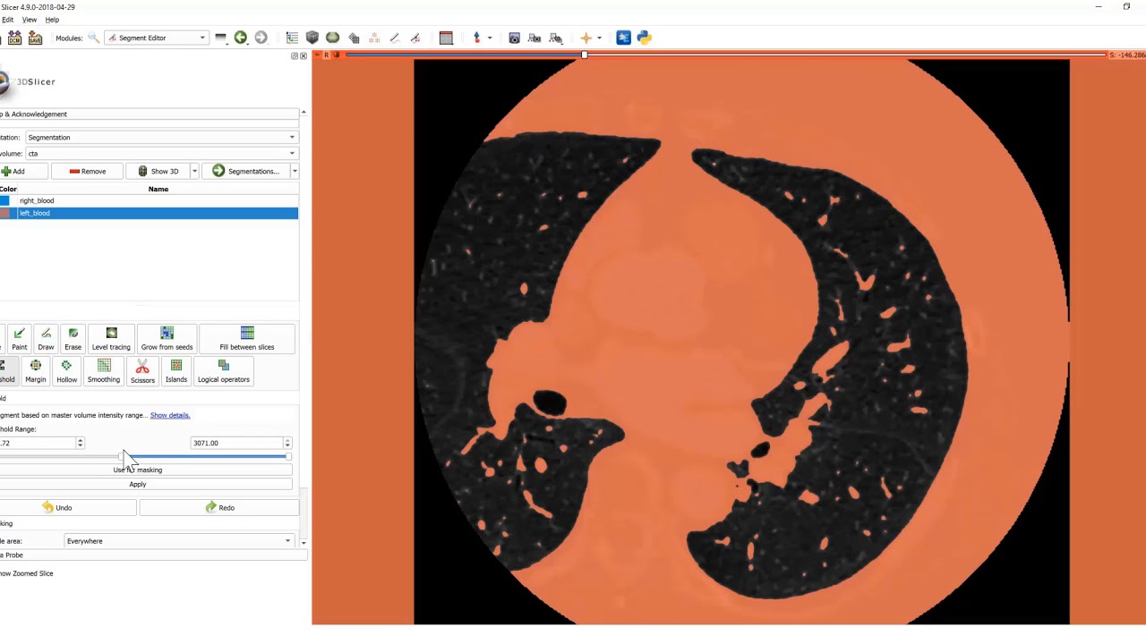Slicer Segment Editor Cardiac Segmentation