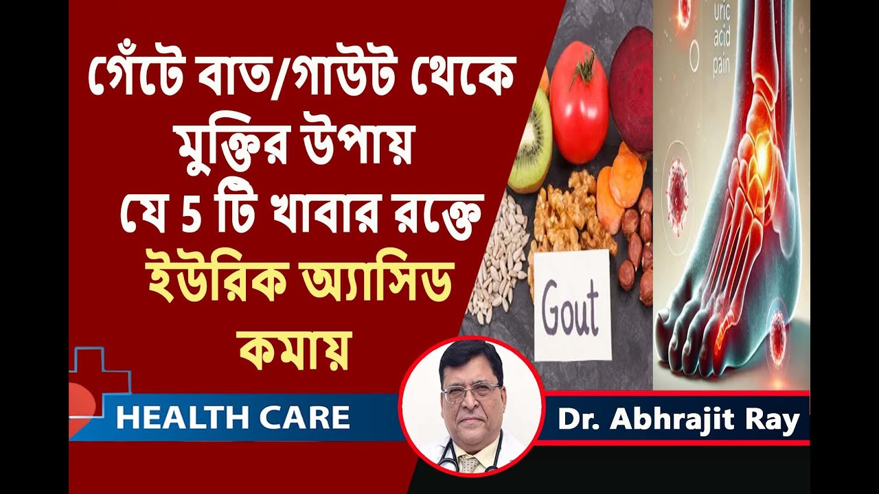 গেঁটে বাত/গাউট থেকে মুক্তির উপায় ৷ যে 5 টি খাবার রক্তে Uric Acid কমায় ৷ বাতের ব্যথায় করণীয় ৷Gout