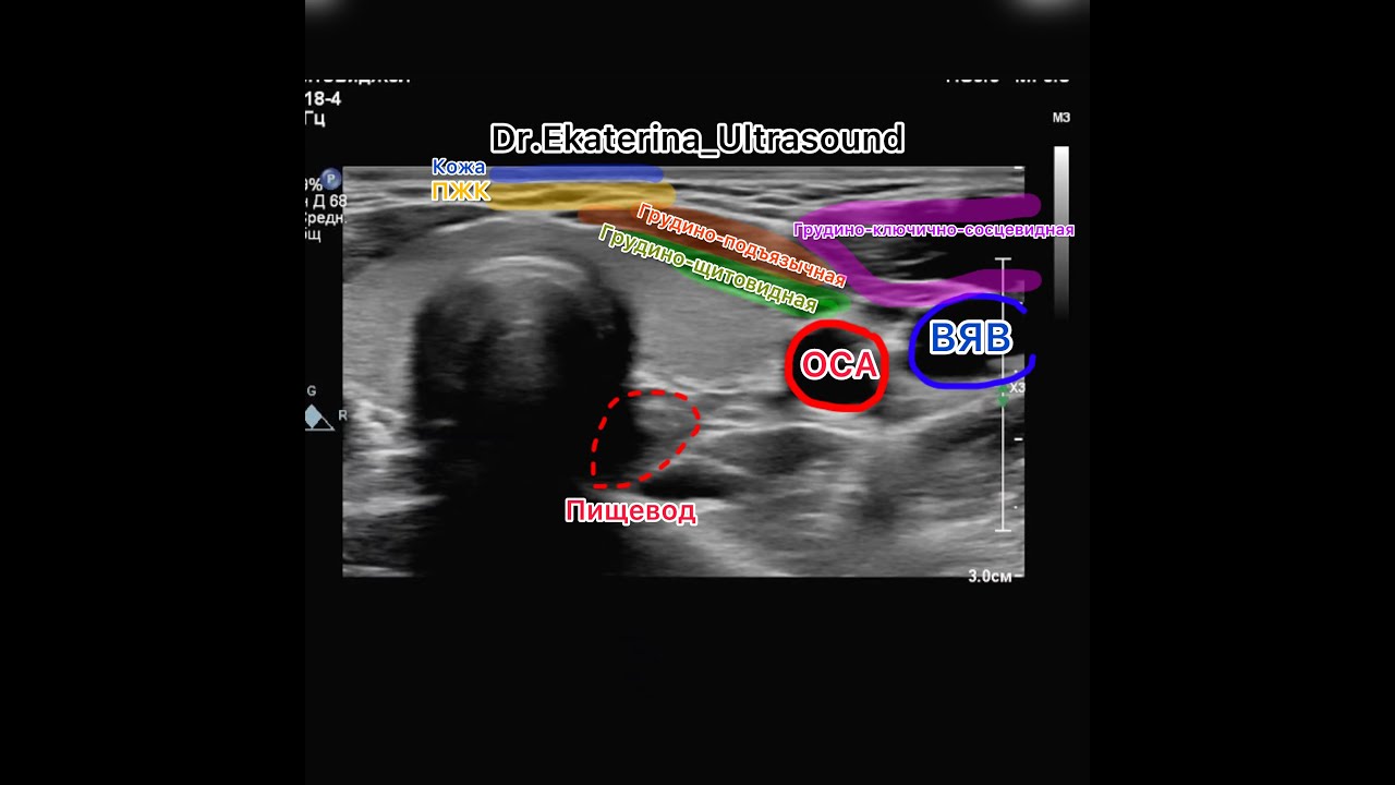 Мастер класс по ультразвуковому исследованию щитовидной железы