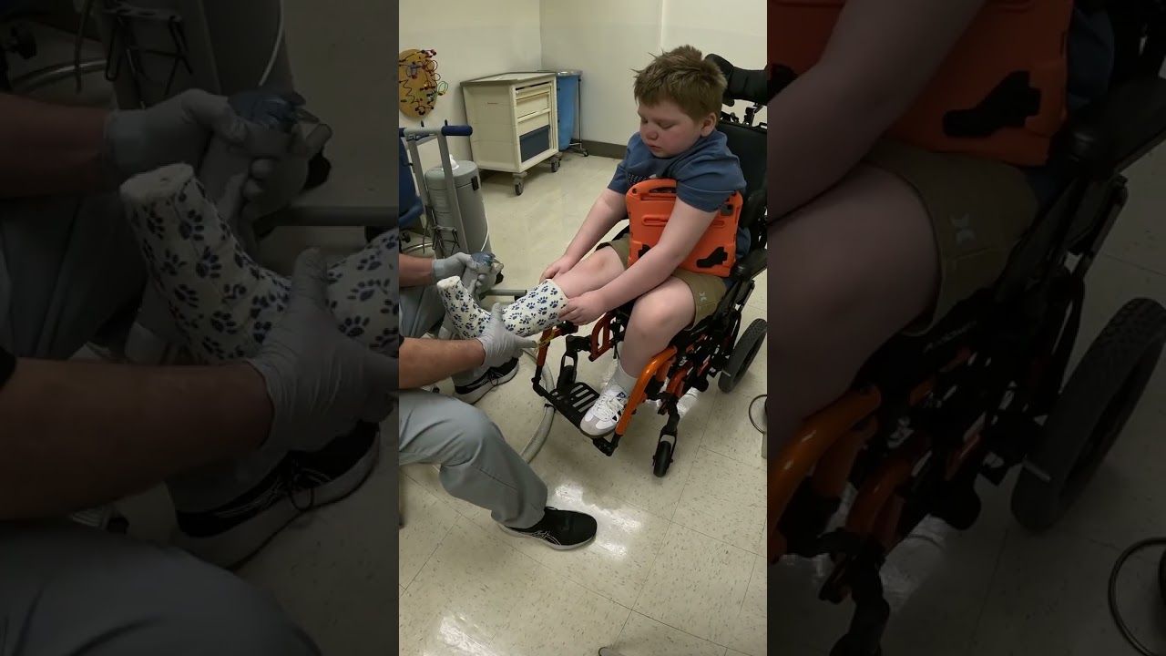 Right foot cast removal #nomorecast #rightfoot #rightfootcastremoval #puppypawprintcast 