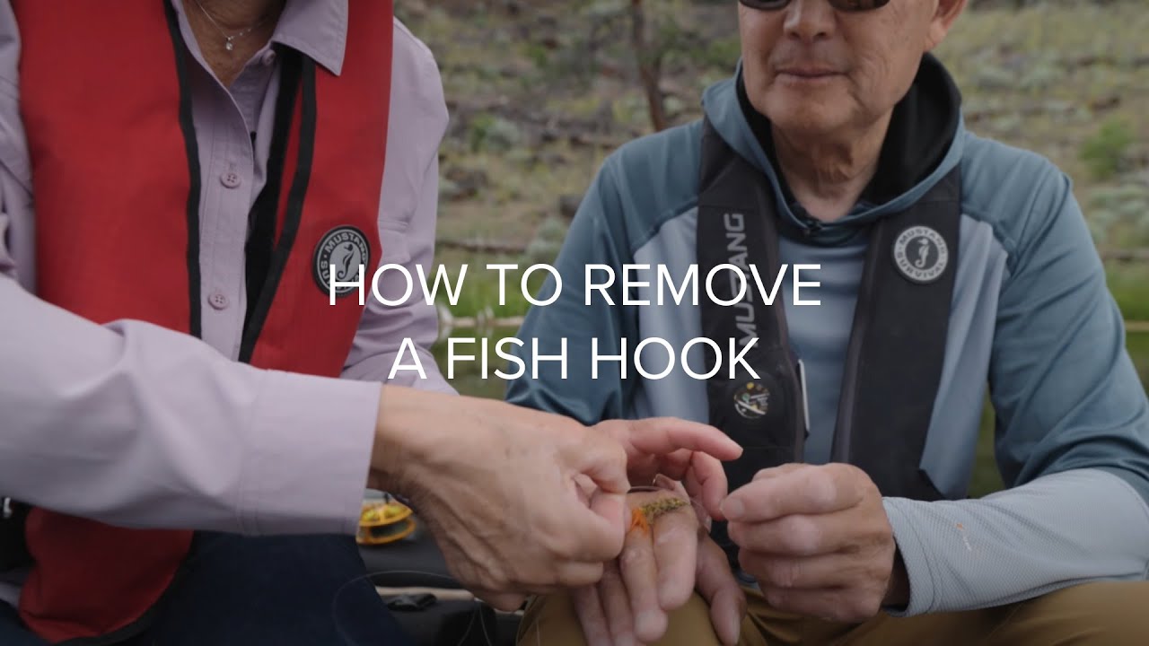 Stillwater Fishing Tips: Removing Hooks