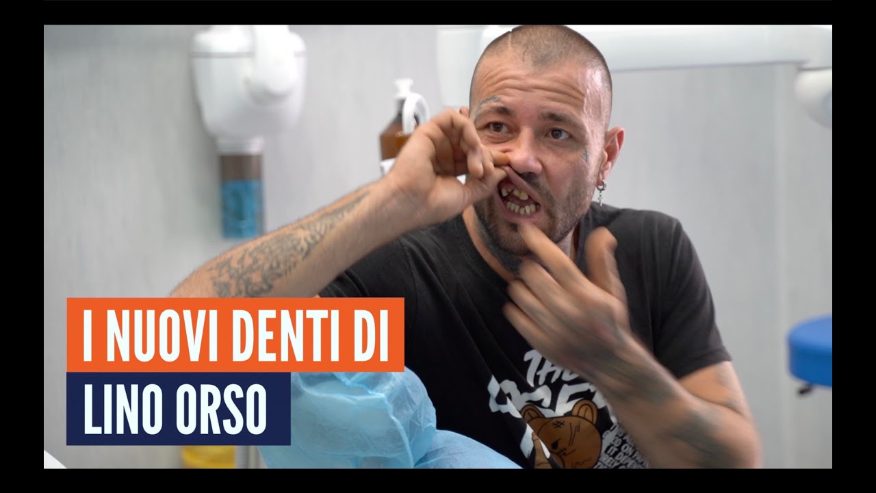 L'operazione ai denti di Lino Orso