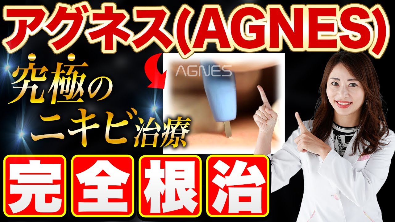 【ニキビ根本治療】アグネス（AGNES） の治療方法とは？ニキビ への効果、メリットについて皮膚科専門医がわかりやすく解説【尋常性ざ瘡】