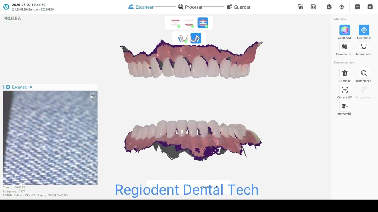 Escáner Intraoral Yucera YRC-S03 