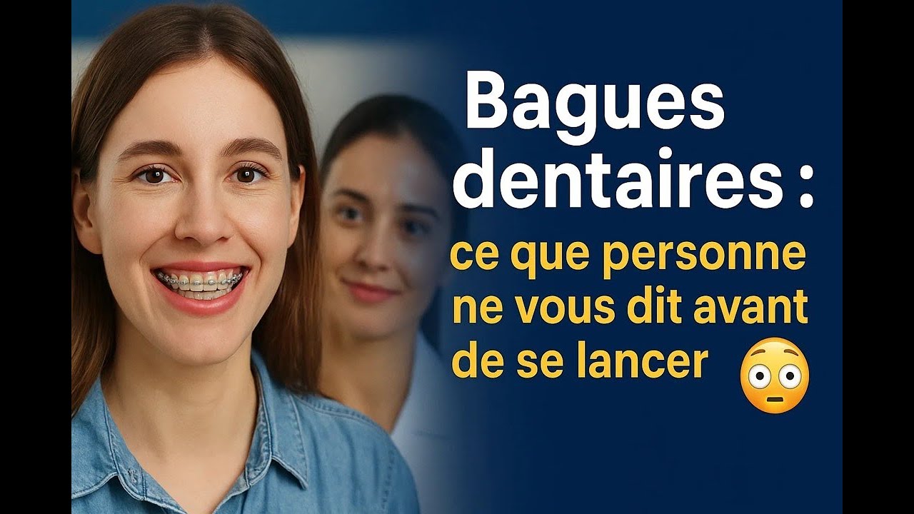 Bagues dentaires : ce que personne ne vous dit avant de se lancer 😲