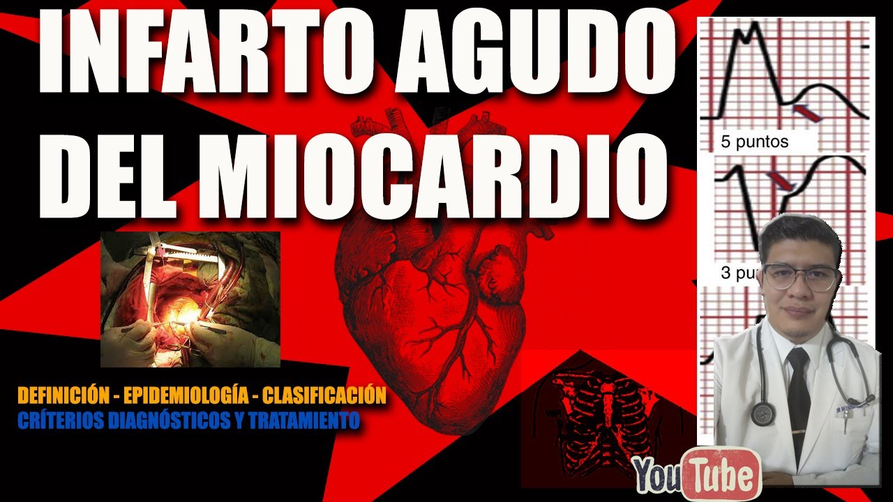 ⏩ INFARTO AGUDO DEL MIOCARDIO      CURSO DE PREPARACIÓN ENARM 2021   CASOS CLÍNICOS ENARM