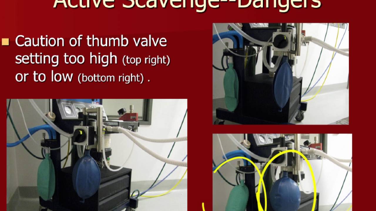 Waste Anesthetic Gases (WAGs): That isn’t Fido’s Gas You Are Smelling - conference recording