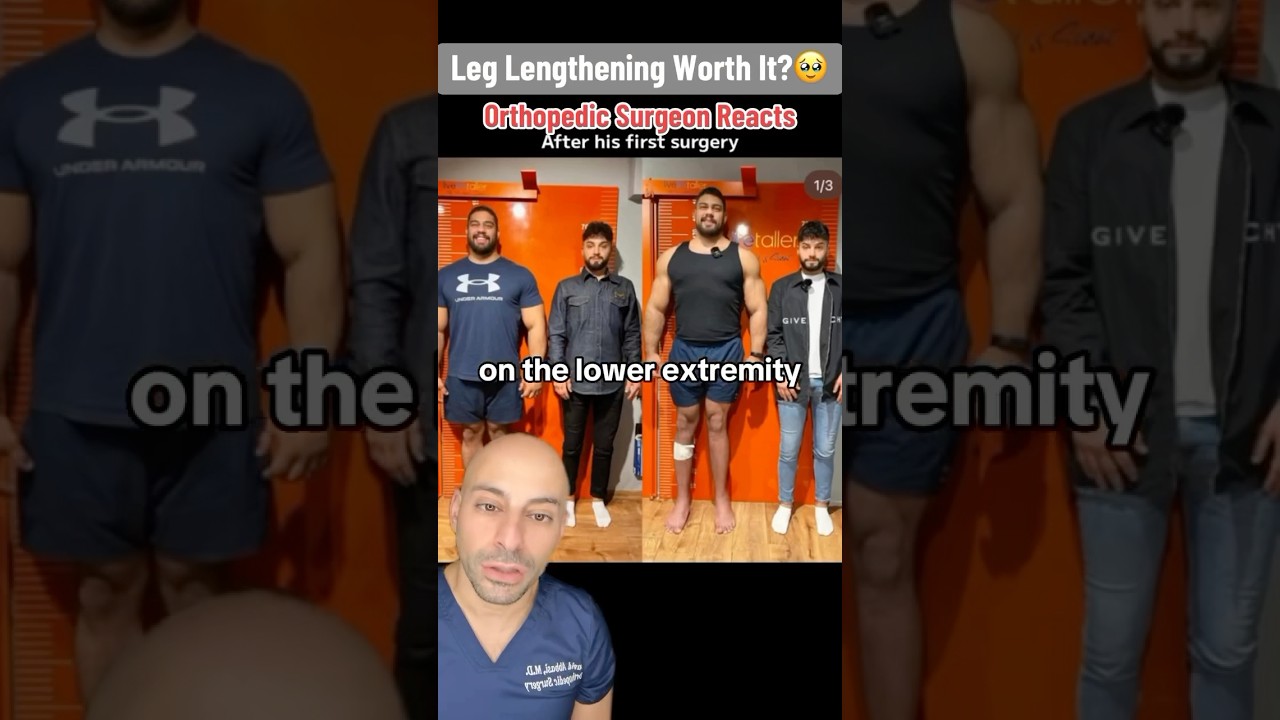 Doctor Explains - Limb Lengthening