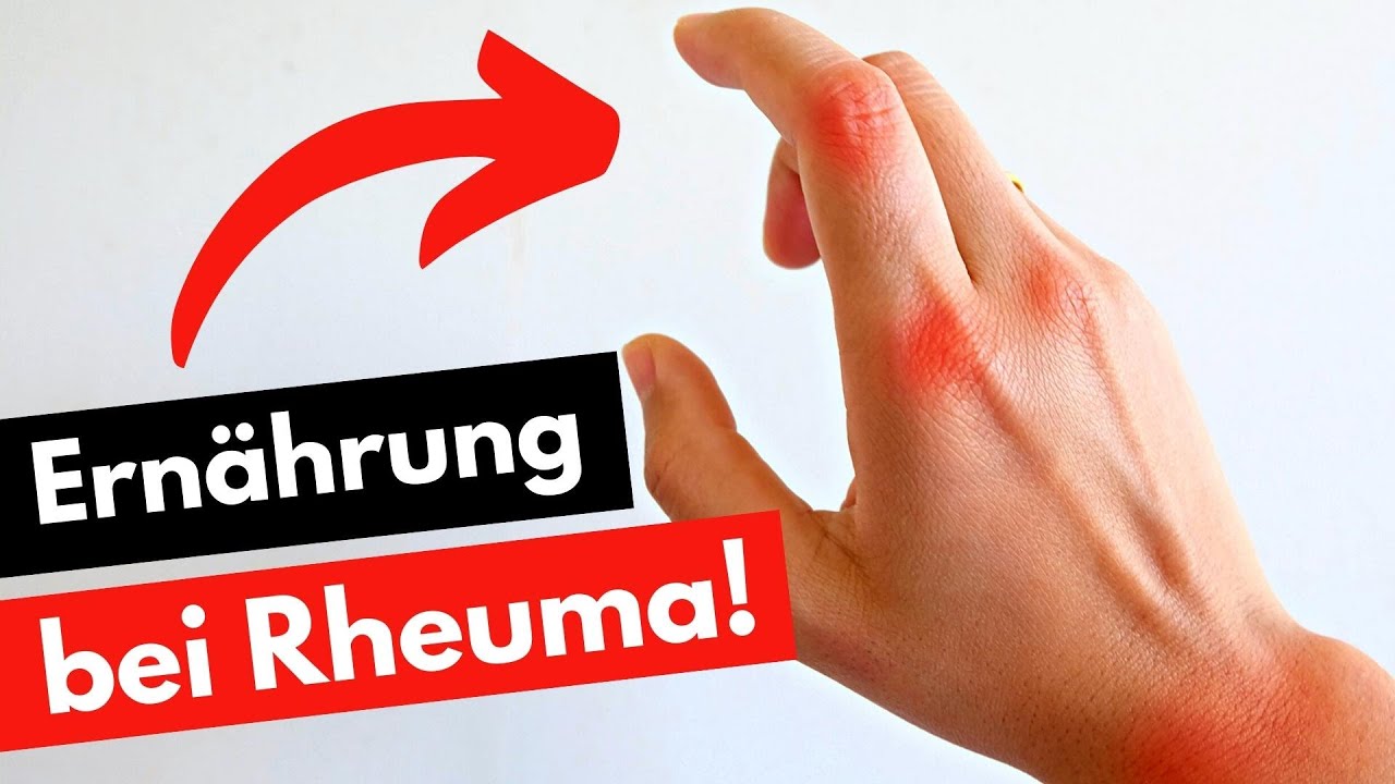 Ern&auml;hrung bei Rheuma: 10 wichtige Tipps f&uuml;r weniger Schmerzen!