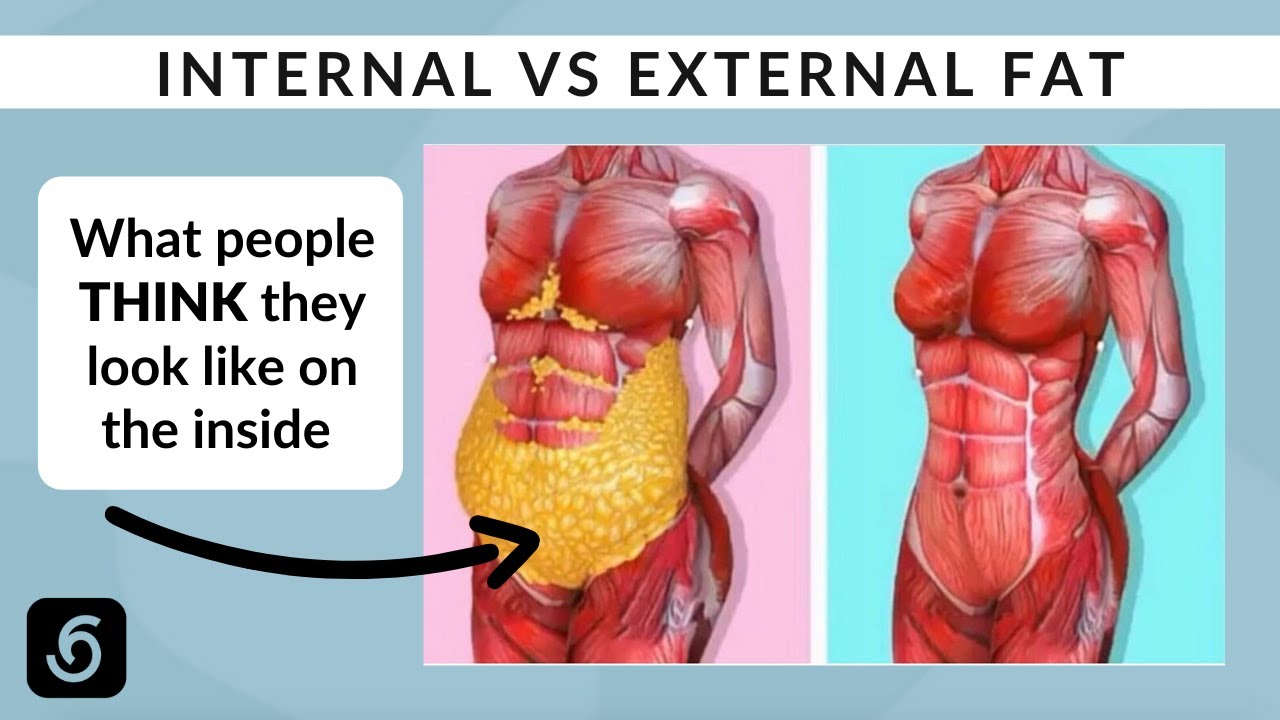 Understanding Internal vs External Fat and Liposuction [VISUAL GUIDE]