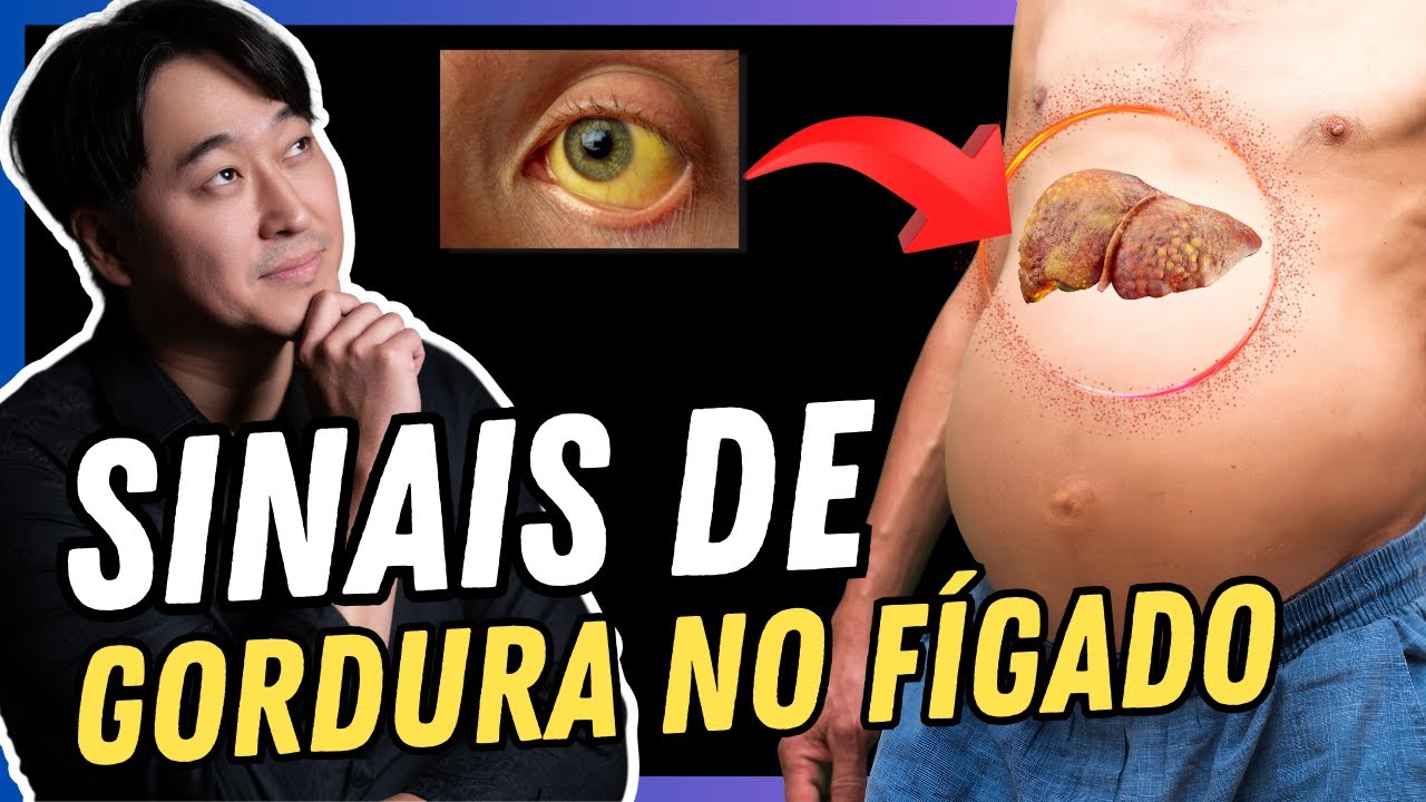 OS 6 SINAIS DE ESTEATOSE HEPÁTICA QUE NINGUÉM FALA.