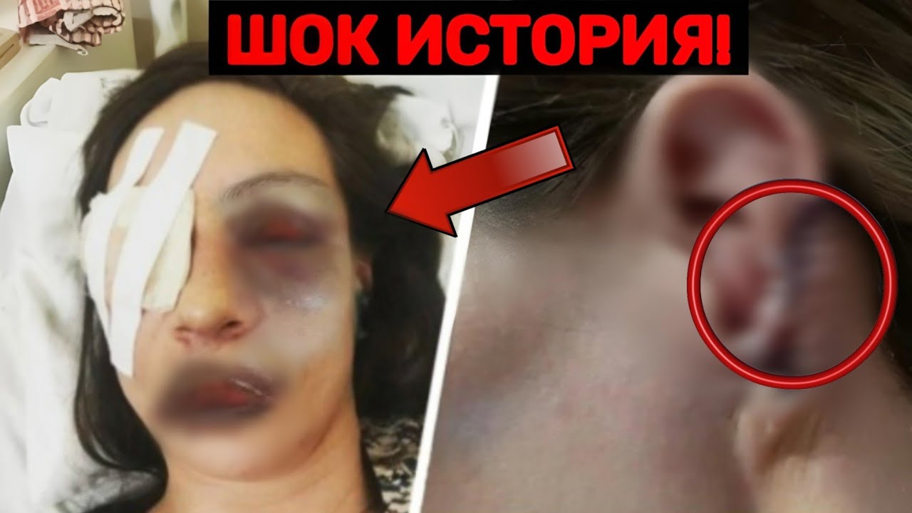 ЖЕСТЬ ИЗ КРАСНОДАРА | МУЖ ВЫДАВИЛ ГЛАЗА ЖЕНЕ ЧТОБЫ ОНА НЕ ЗАГУЛЯЛА 