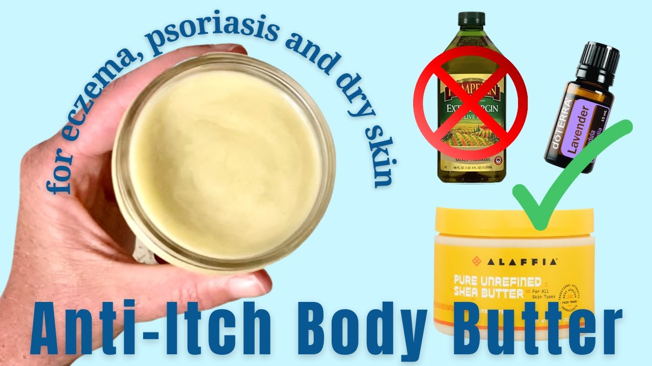 Anti-Itch Body Butter for Eczema, Dry Skin and Psoriasis | STOP using Olive Oil
