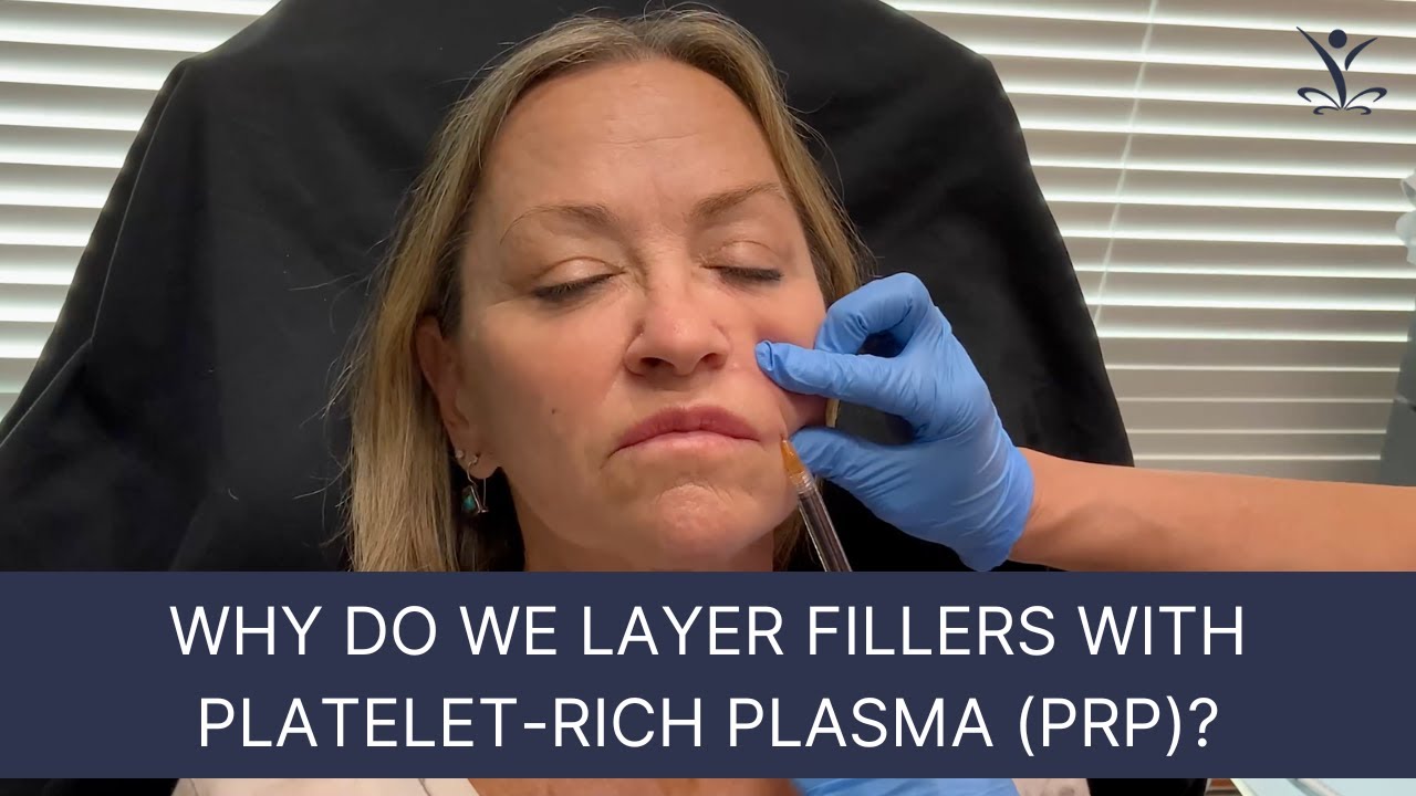 What is the Vampire Facelift?
