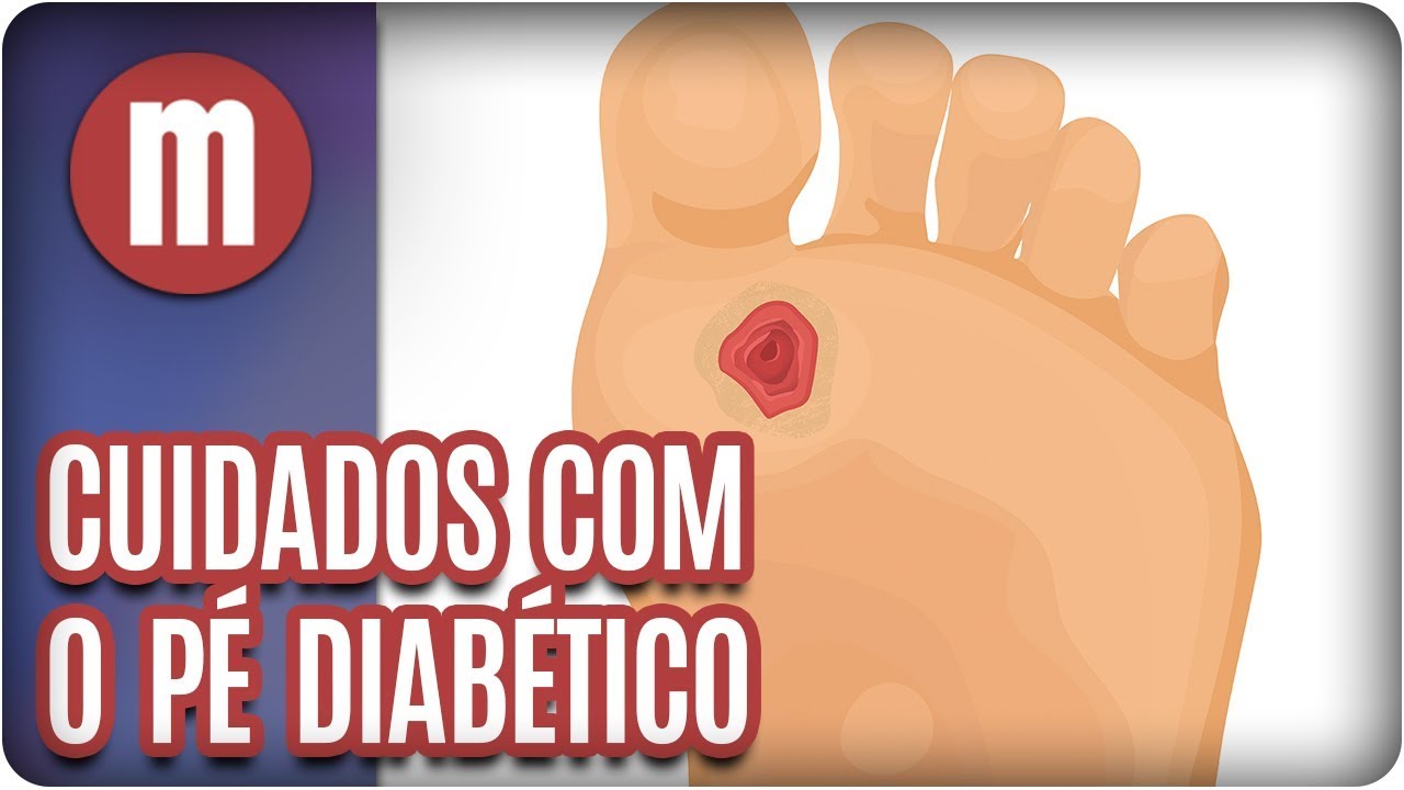 Cuidados com o pé diabético - Mulheres (05/10/17)