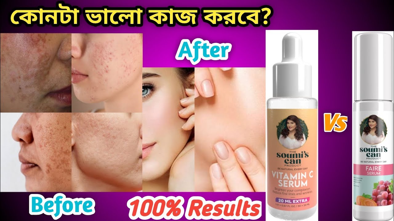The Soumi's Can Product Vitamin C Serum Vs The Soumi's Can Faire Serum