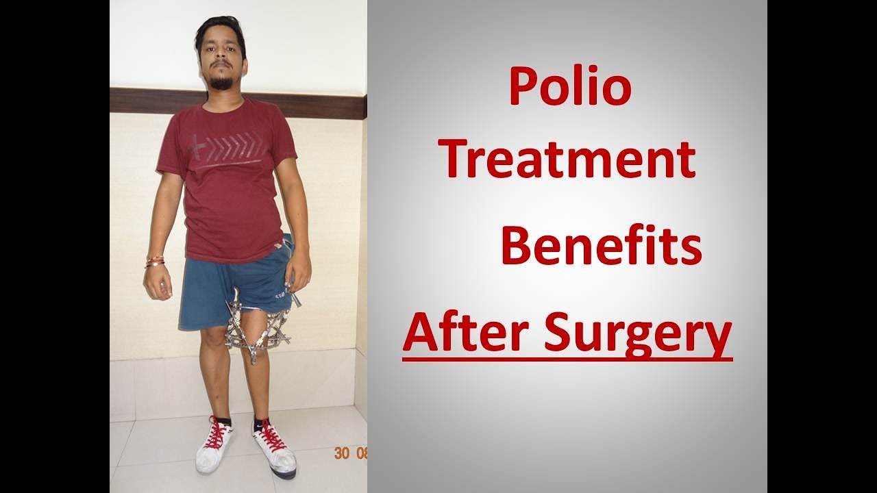 Polio Treatment Benefits - After Surgery