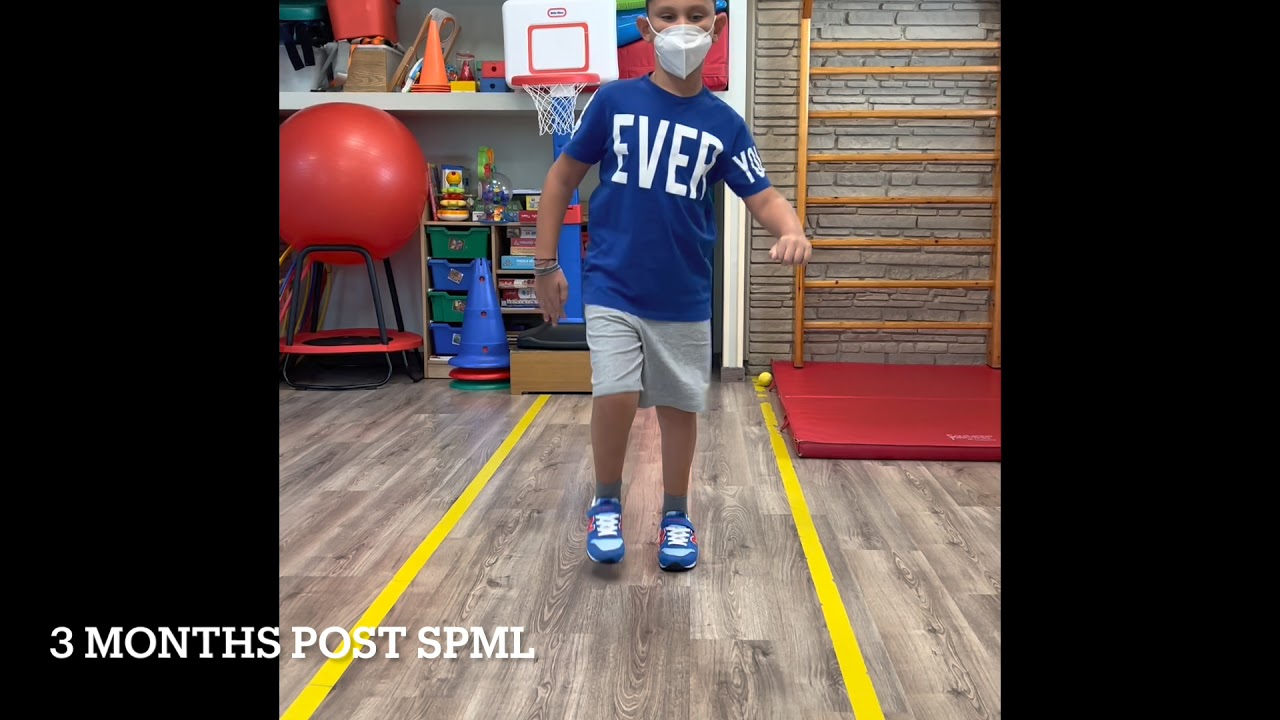 SPML Case