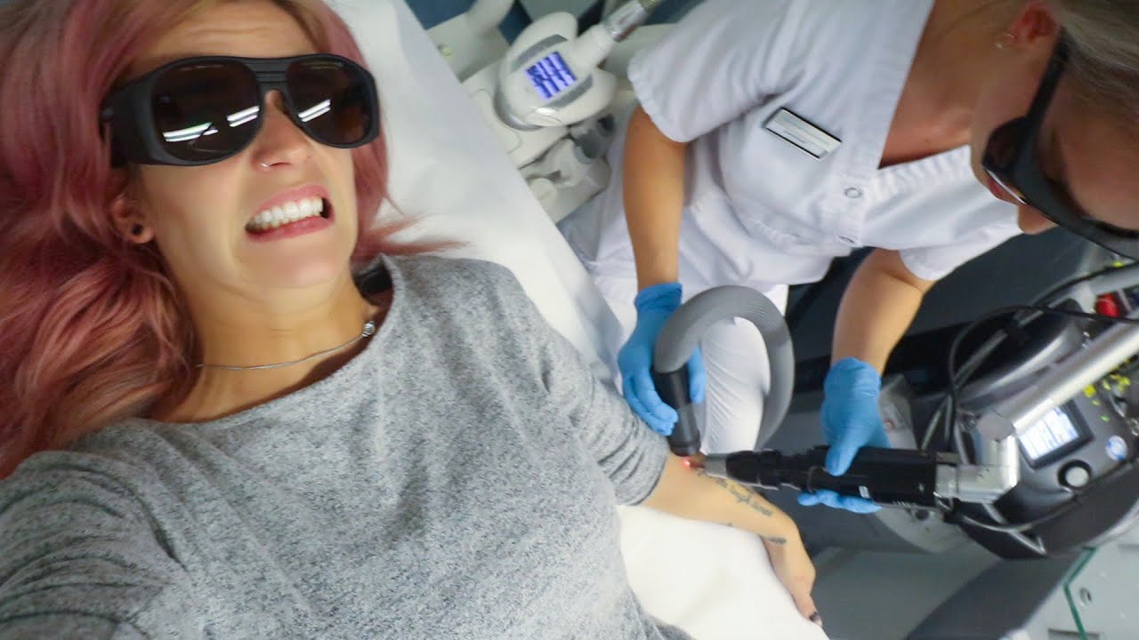 SPIJT VAN TATTOO | Mijn Laserbehandeling