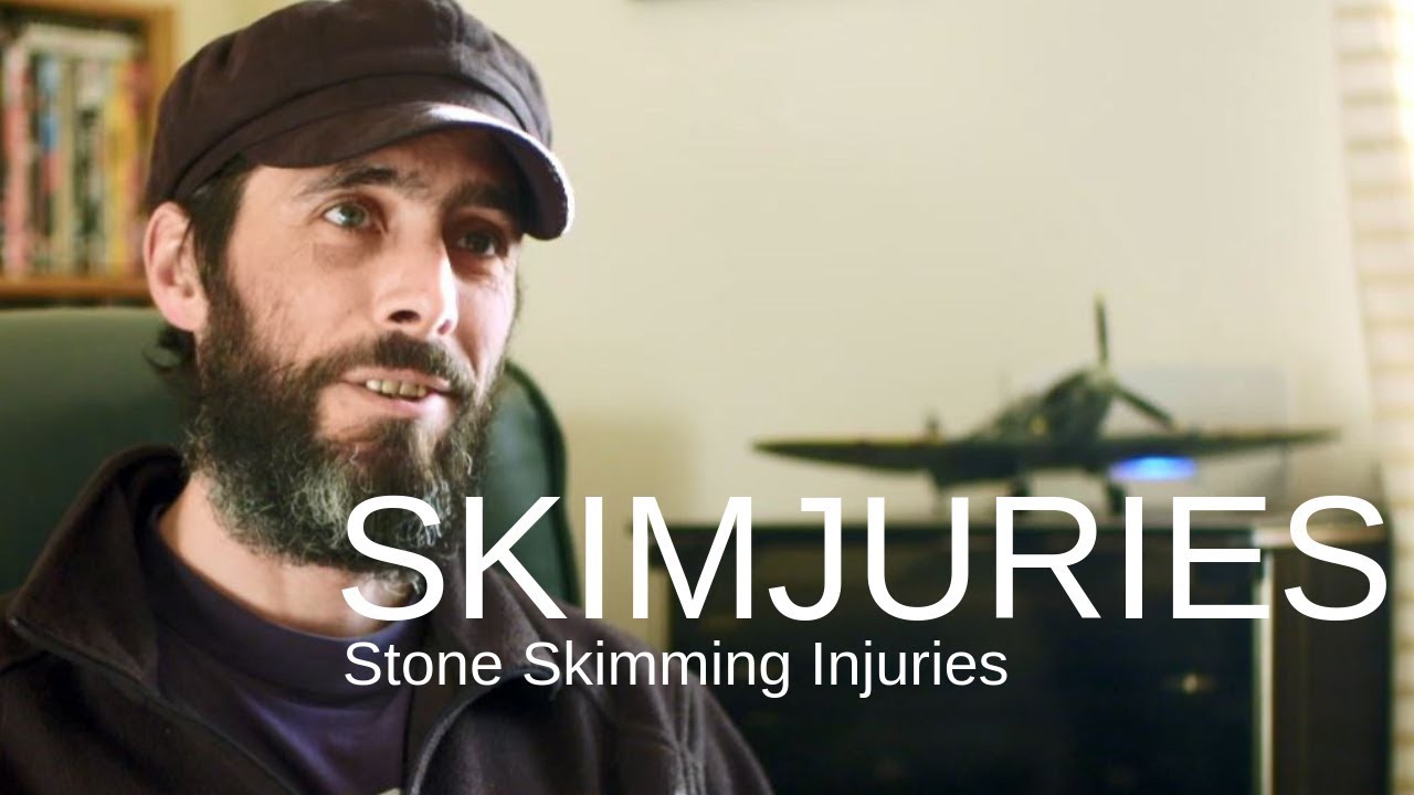 Skimjuries: Stone-skimming injuries | Sink or Skim
