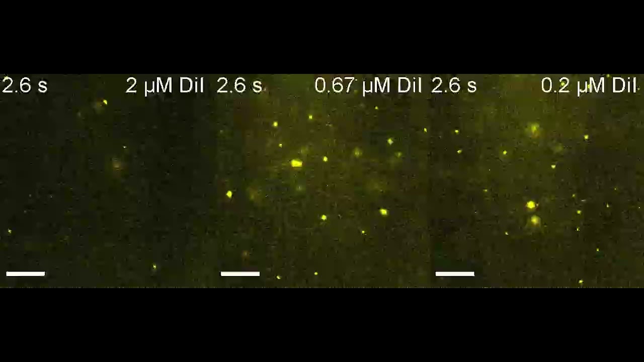 Fluorescent labeling of extracellular vesicles