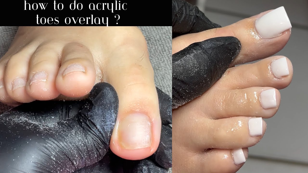 HOW TO DO ACRYLIC TOES OVERLAY | ACRYLIC TOE TUTORIAL | YOUNG NAILS ACRYLIC | WHITE TOES