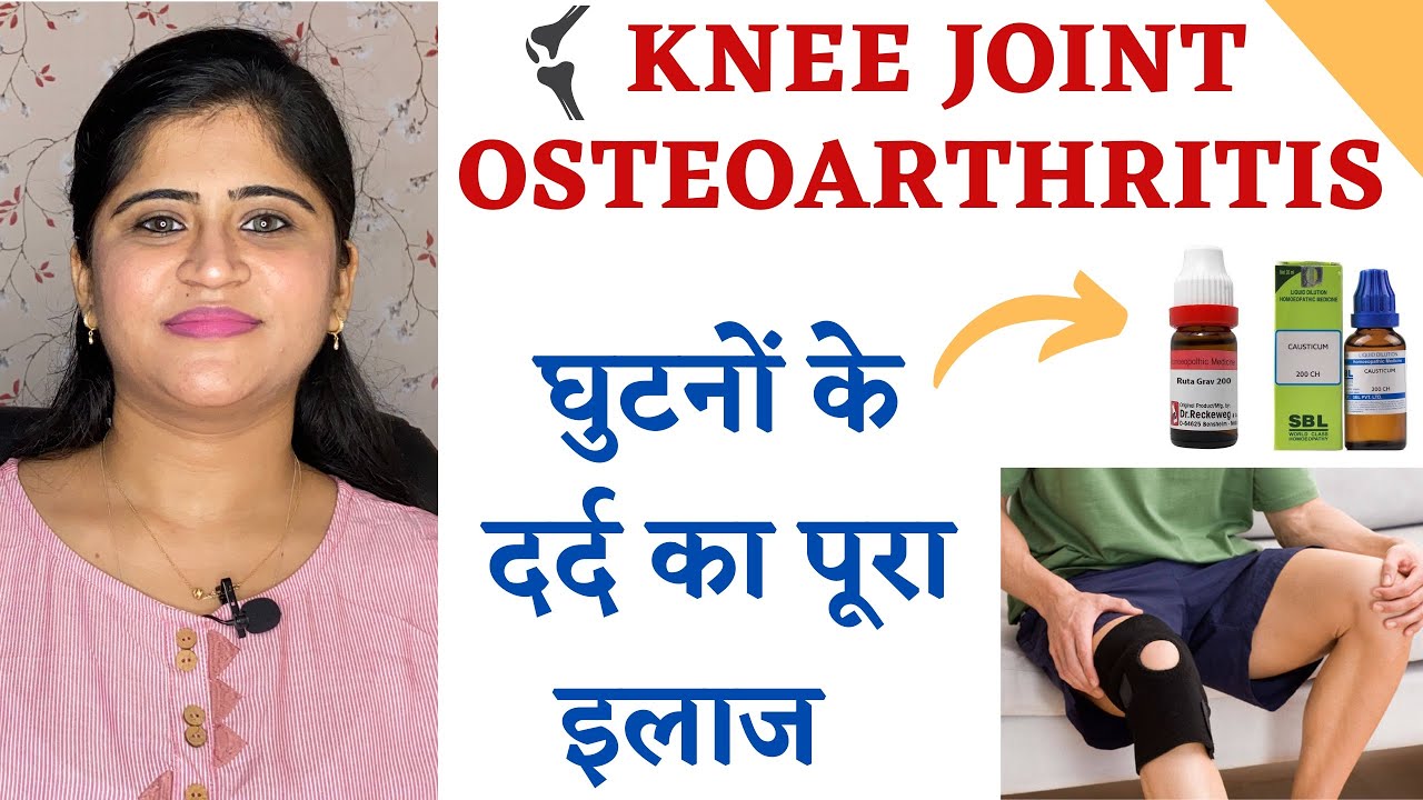 Knee Joint Pain || Joint pain homeopathic medicine || knee osteoarthritis Treatment