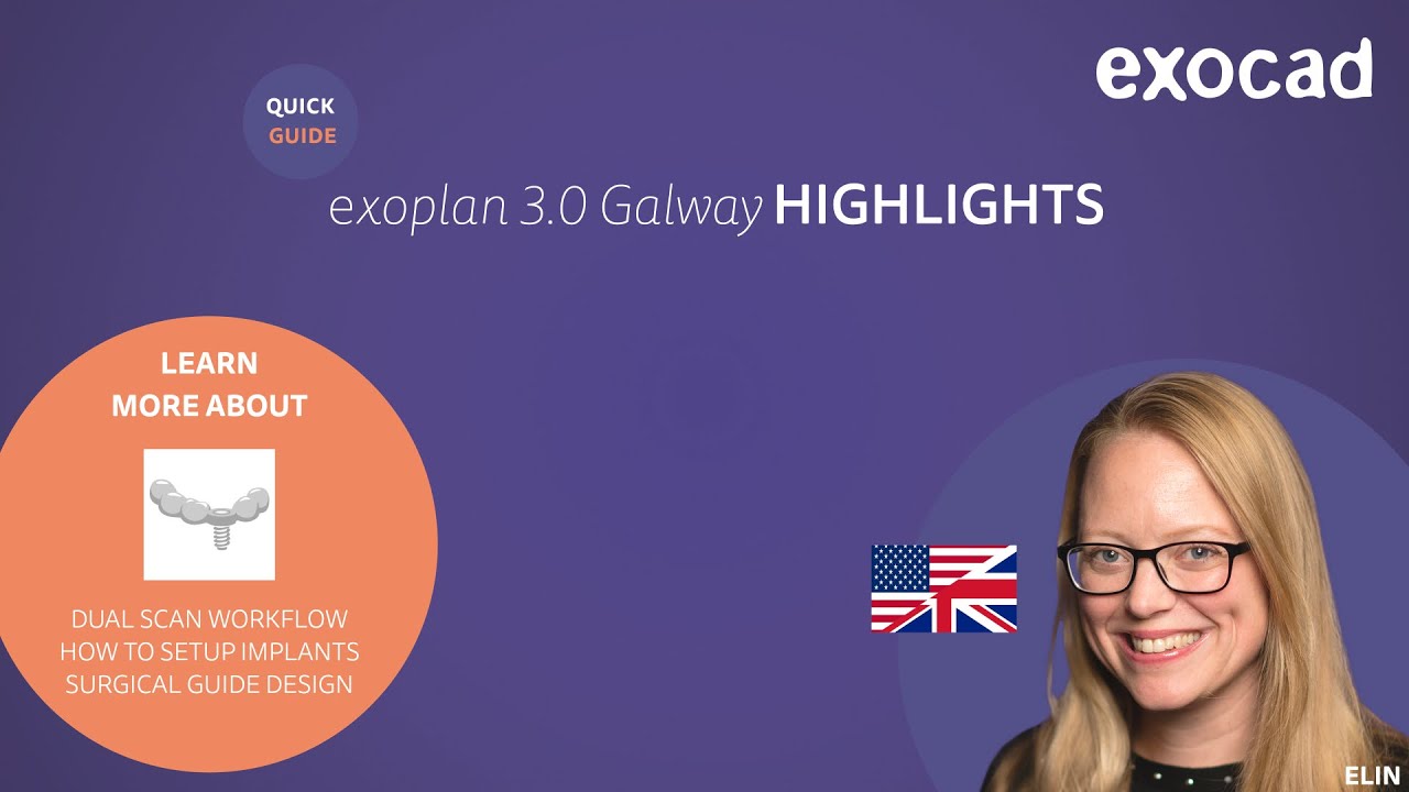 exoplan 3.0 Galway HIGHLIGHTS
