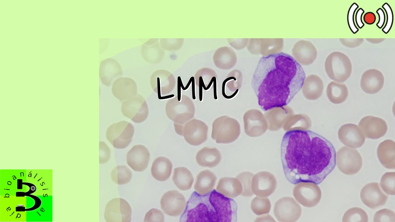 🧿LMMC