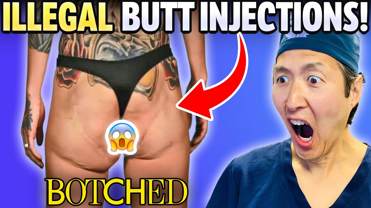 Her Butt Was BOTCHED! Extreme Compilation of Plastic Surgeon Reacts to BOTCHED