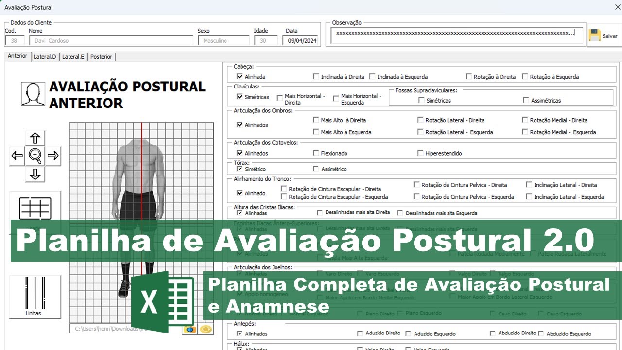 Planilha de Avaliação Postural 2.0 Excel