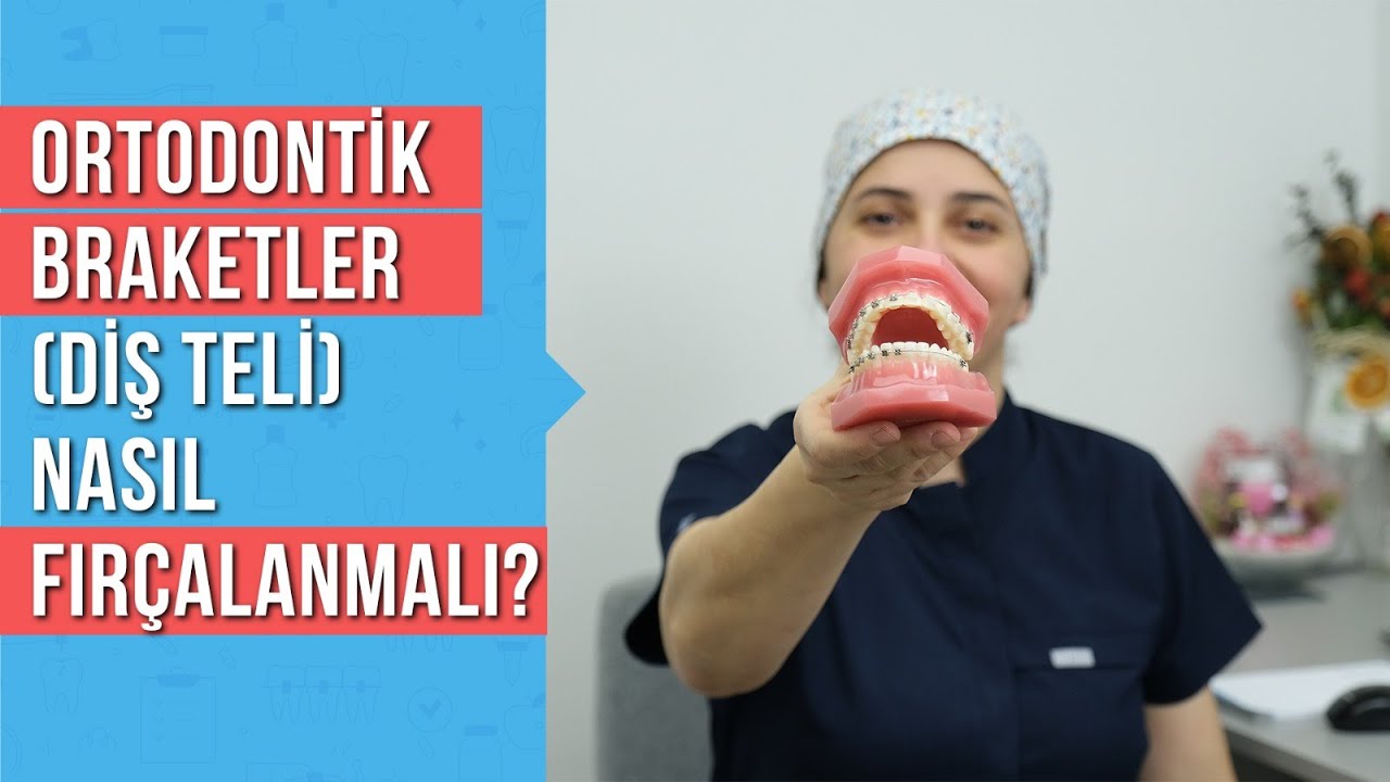 Ortodontik Braketler (Diş Teli) varken nasıl diş fırçalanır?