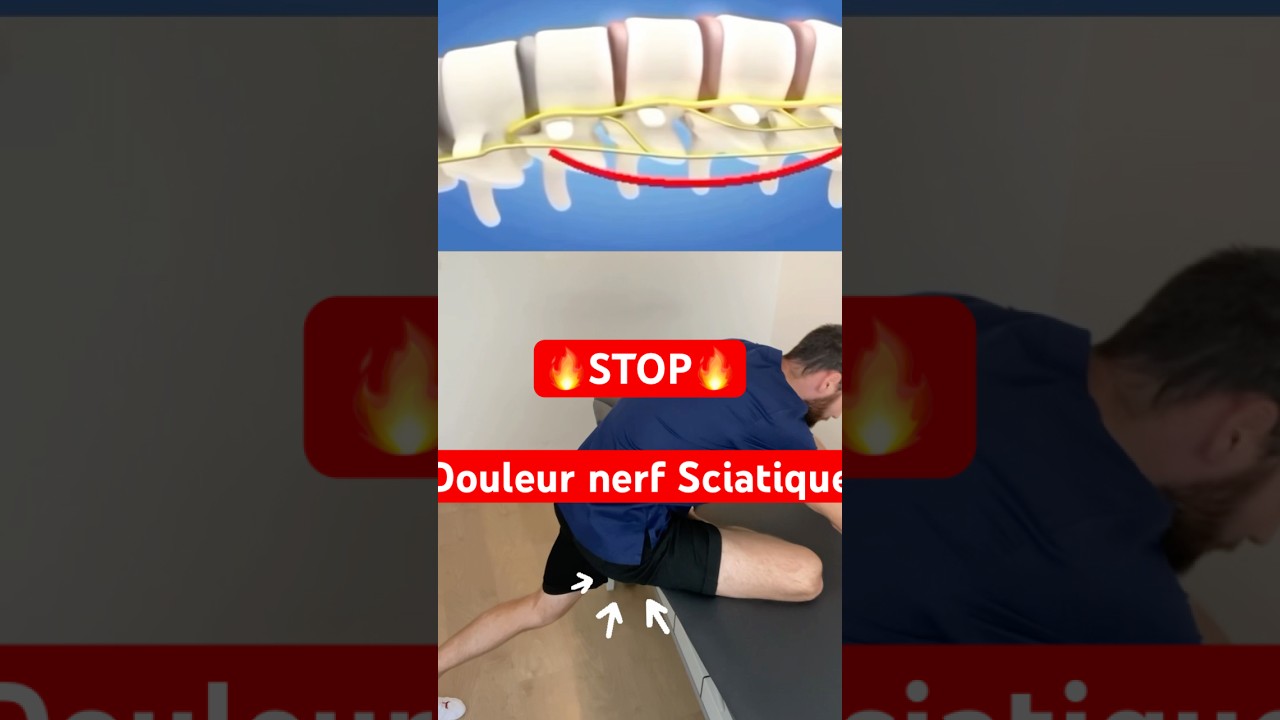 Tu as mal au nerf sciatique ? Fais ça tous les jours ! 3 fois 20 SEC