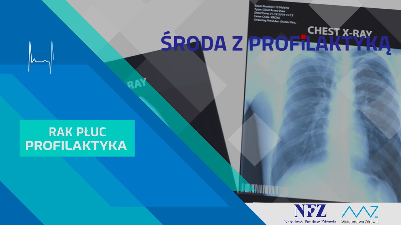 Rak płuc. Profilaktyka