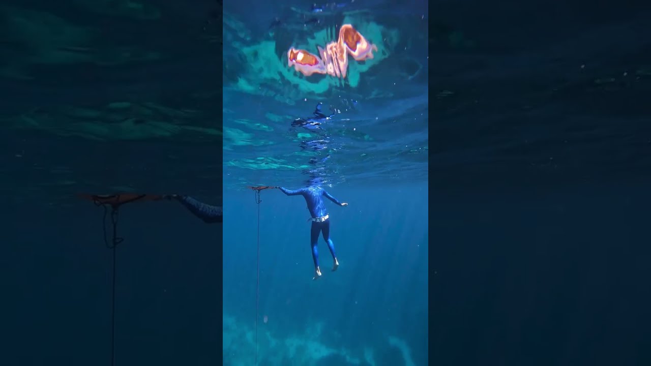 DNF S T OM - FIRST APNEA DAY -