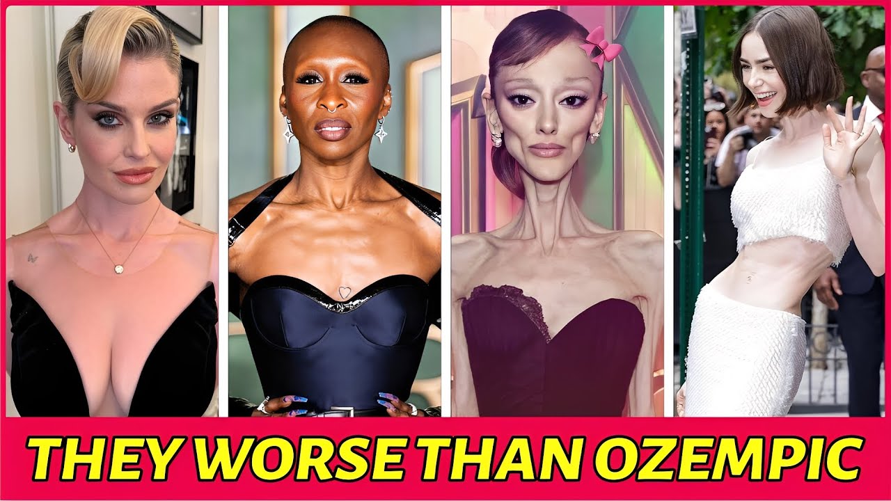 24 Celebrity Ozempic Transformations That Backfired Horribly