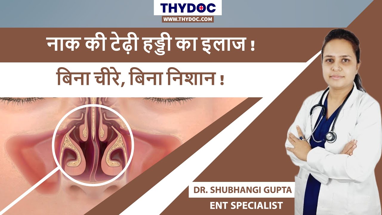 नाक की टेढ़ी हड्डी का इलाज, Naak Ki Haddi Ka Badhna, Nakki Ki Haddi Ka ilaaj, Dr. Shubhangi Gupta