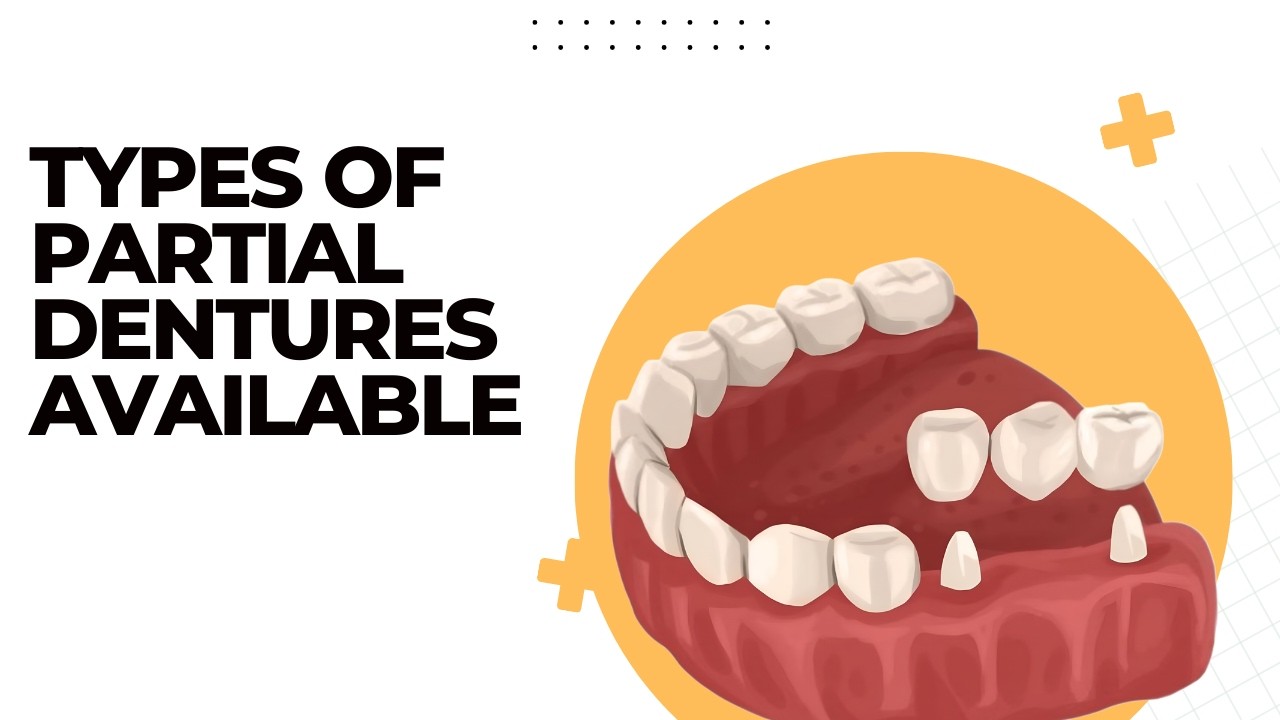Types of Partial Dentures Available | Shrouf Dental House