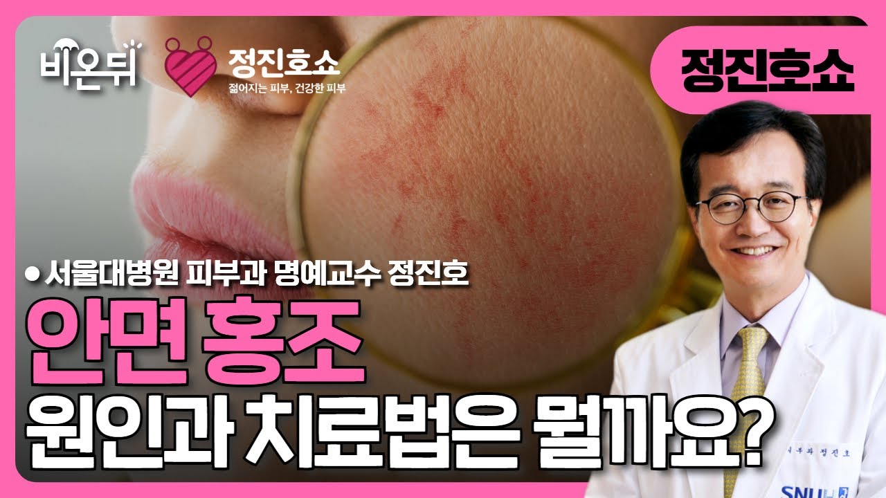 [정진호쇼, 젊어지는 피부 건강한 피부] 안면 홍조의 원인과 치료 / 서울대병원 피부과 명예교수 정진호