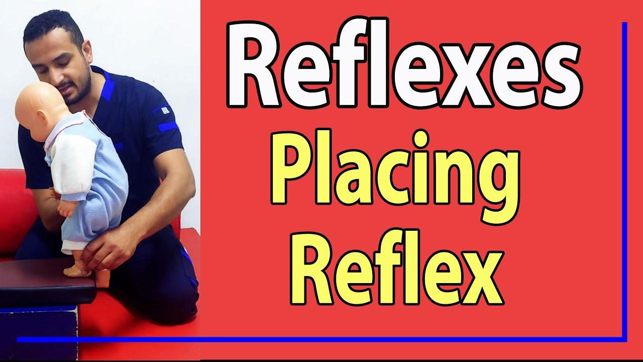 23 Placing (stepping) Reflex