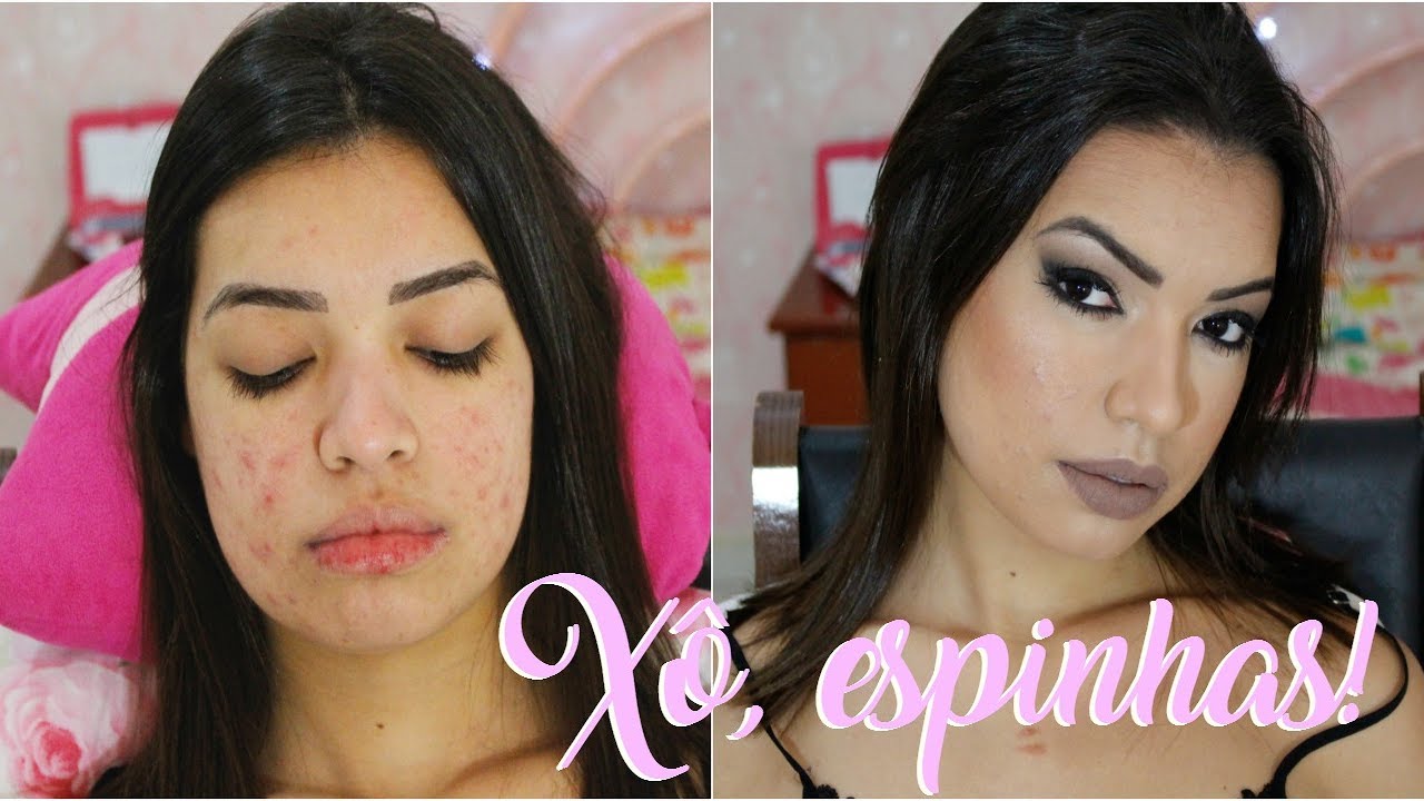 COMO ESCONDER ESPINHAS COM MAQUIAGEM - Make para pele com acne