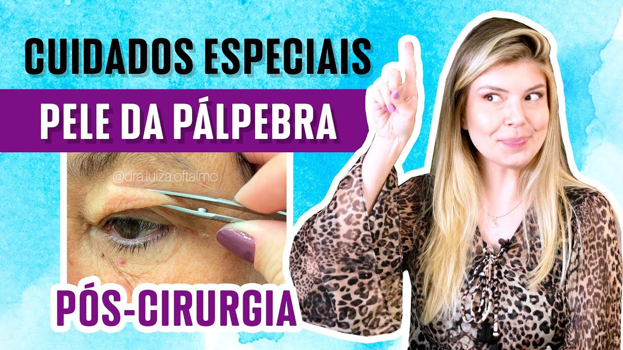 Cuidados especiais no pós-operatório de blefaroplastia